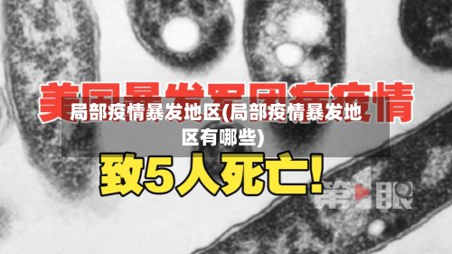局部疫情暴发地区(局部疫情暴发地区有哪些)-第2张图片