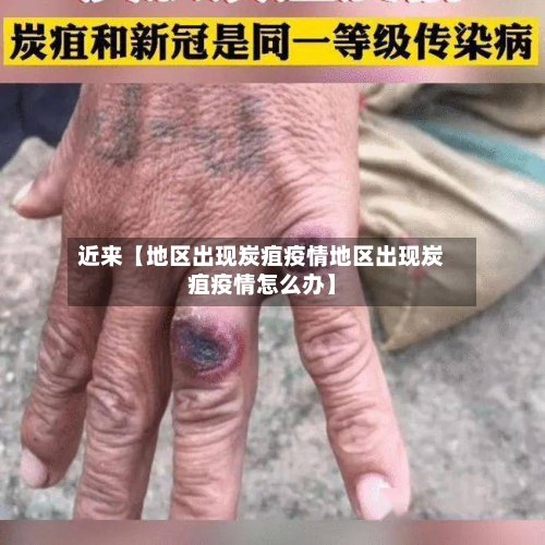 近来【地区出现炭疽疫情地区出现炭疽疫情怎么办】-第2张图片