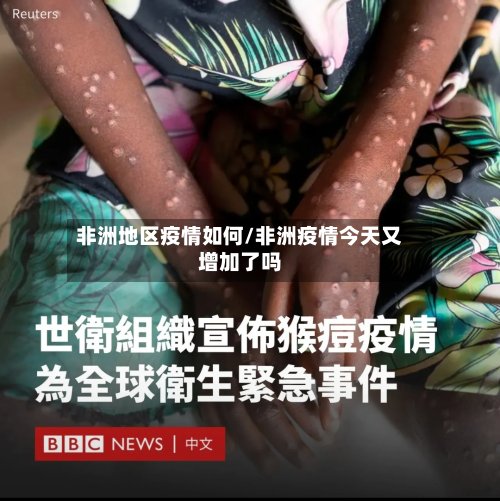 非洲地区疫情如何/非洲疫情今天又增加了吗-第3张图片